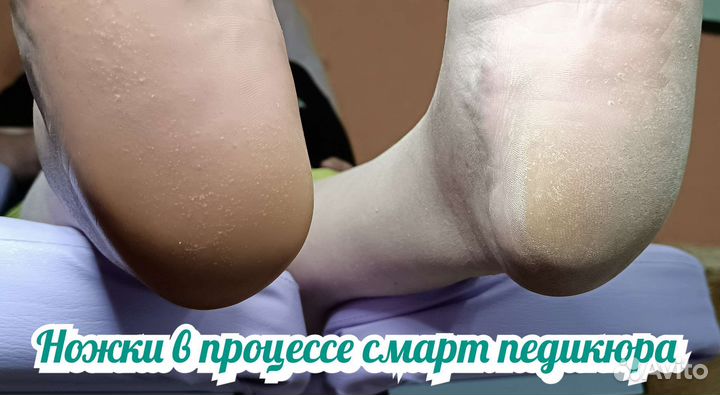 Педикюр в Ступино