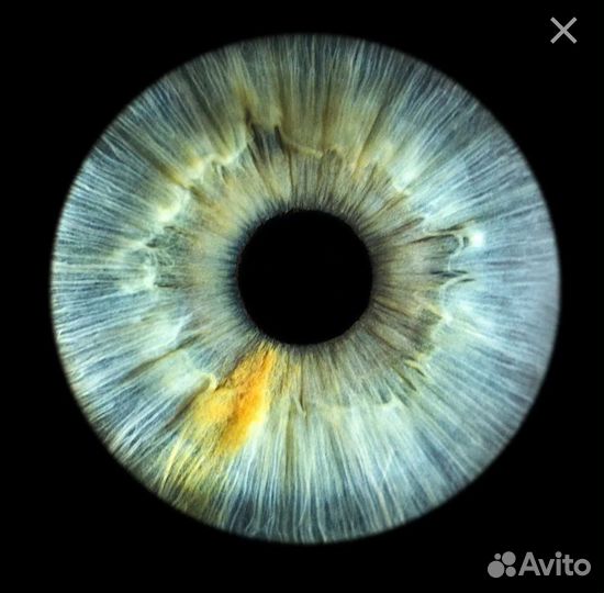 Фото радужки глаза