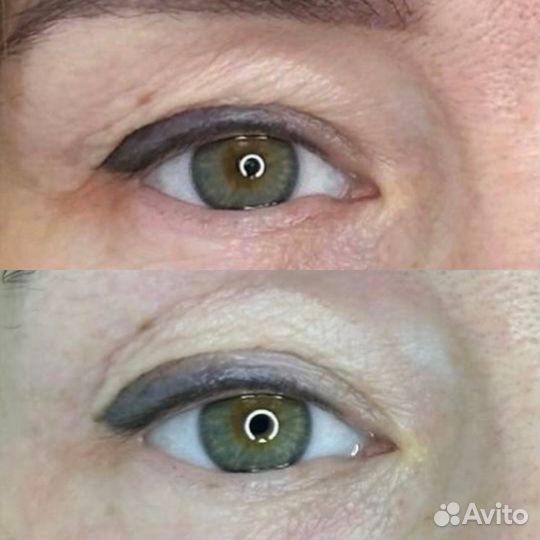 Холодная плазма