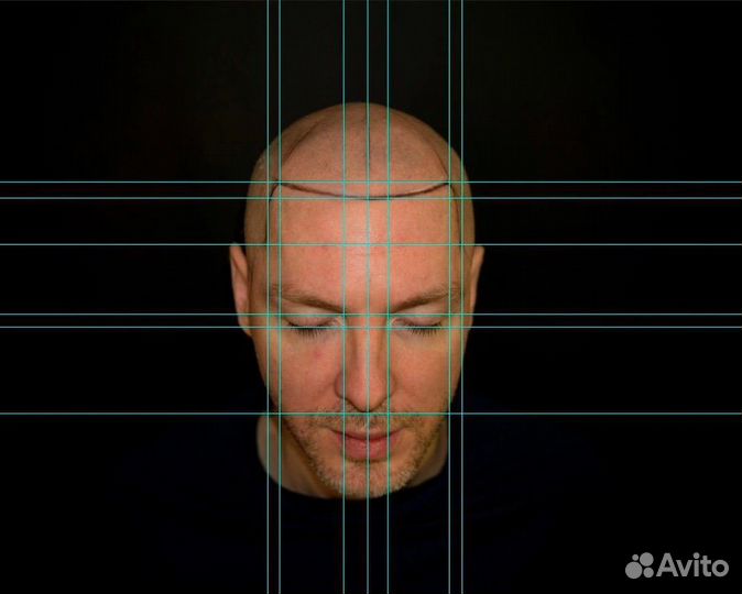 Тату волос SMP трихопигментация