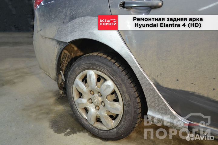 Hyundai Elantra IV (HD) арки