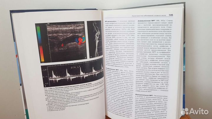 Неврология