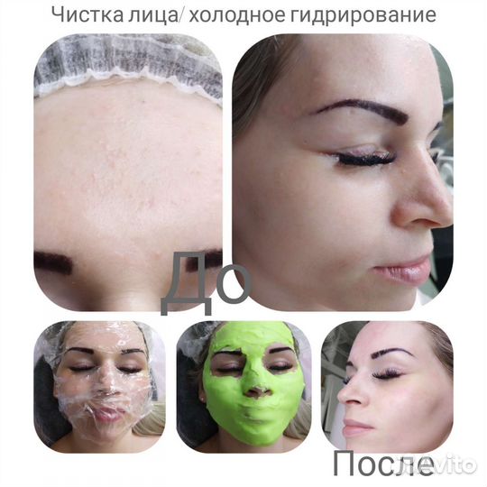 Чистка лица/пилинги/карбокситерапия