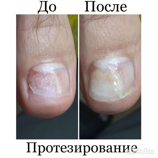 Услуги подолога