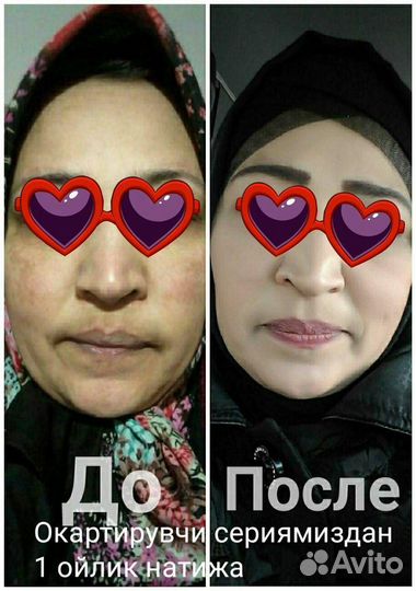 Чистка и массаж лица