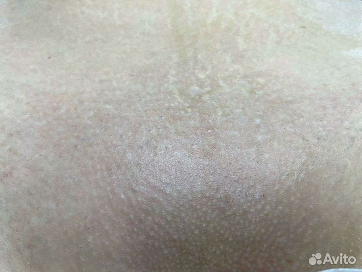 Восковая депиляция,шугаринг