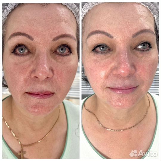 Косметолог-эстетист