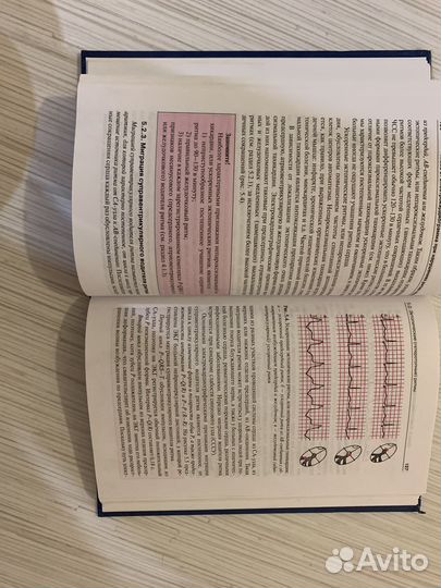 Экг диагностика Струтынский