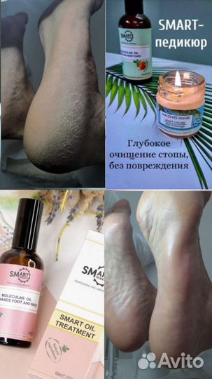 Smart педикюр с элементами подологии, маникюр