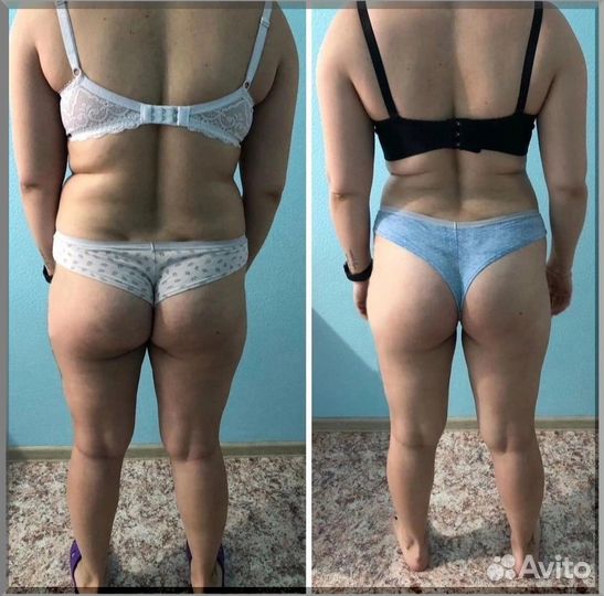 5 процедур для похудения