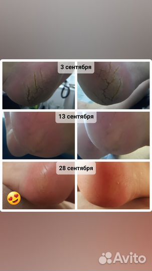 Подолог, педикюр, маникюр