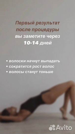 Лазерная эпиляция