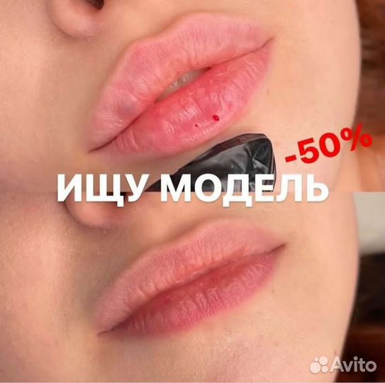 Модели на увеличение губ и ботекс(лоб, глаза, межб