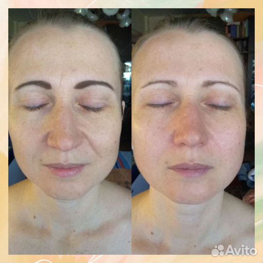 Массаж лица и тела