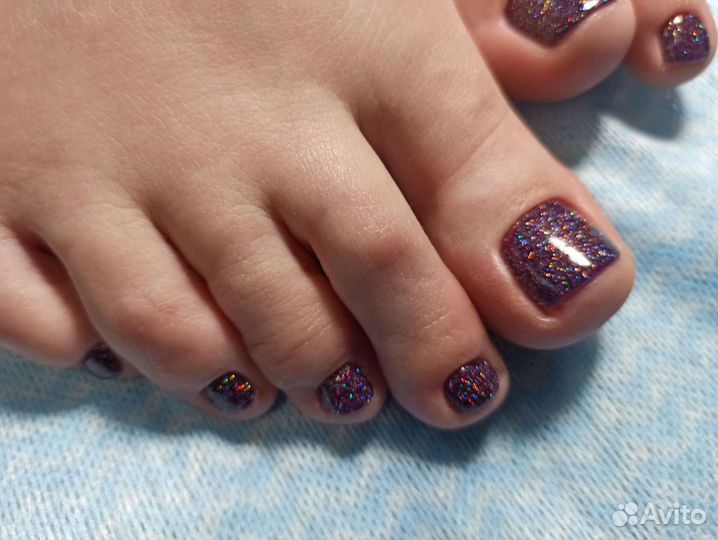 Полный педикюр. Вросший ноготь. Титановая нить