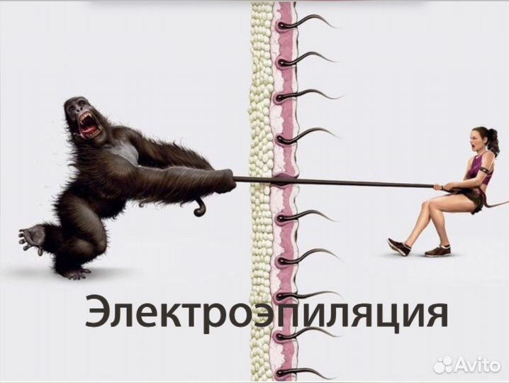 Электроэпиляция Ишим
