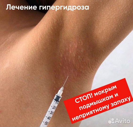 Ботокс для лица