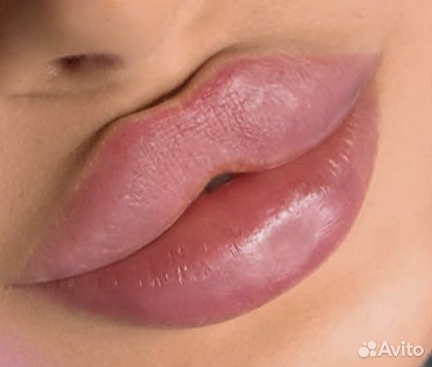 Модель на увеличение губ