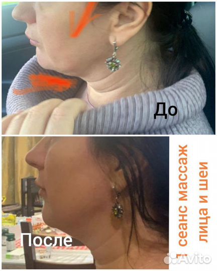 Массаж. Здоровье и красота вашего тела и лица