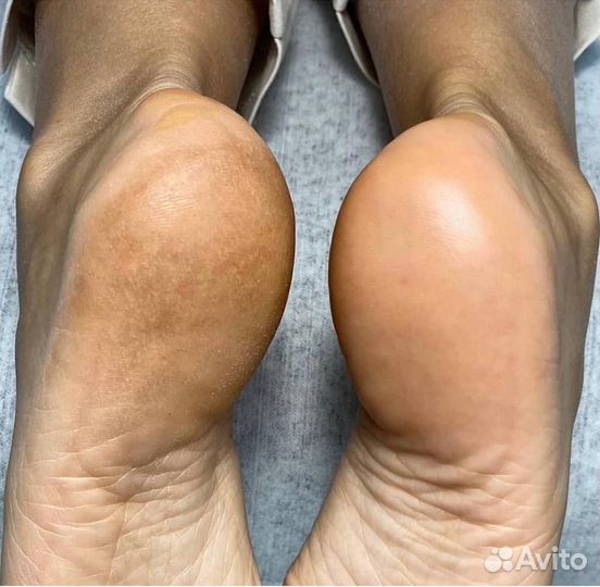 Мастер маникюра педикюра