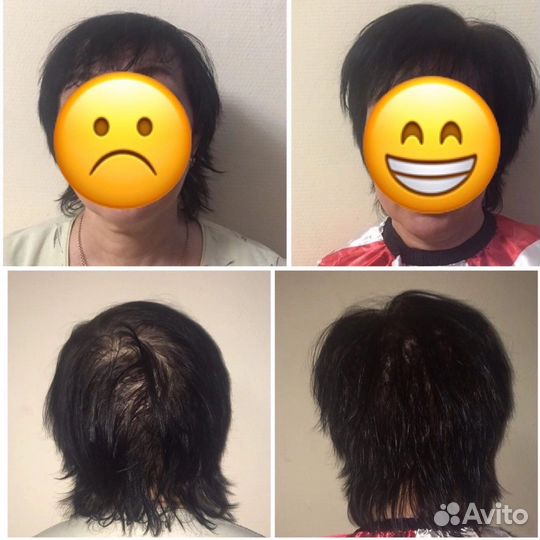 Прикорневой объем волос