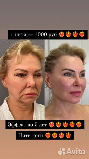 Модель на косметологию