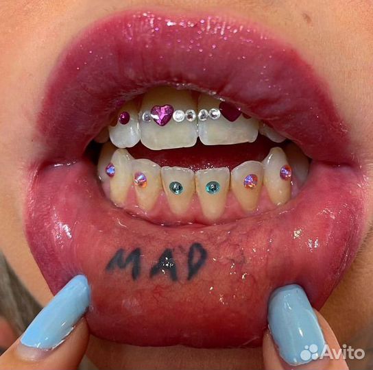 Установка скайсов