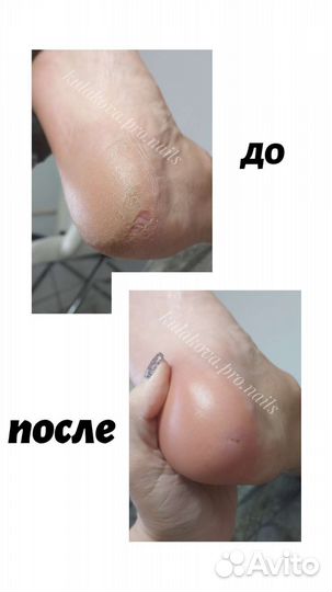 Маникюр, smart-педикюр, наращивание