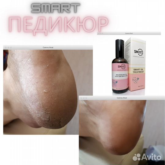 Педикюр с покрытием лаком