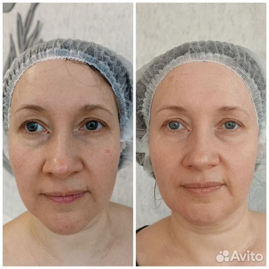 Модель на массаж лица