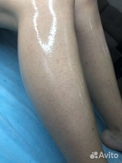 Шугаринг/ваксинг