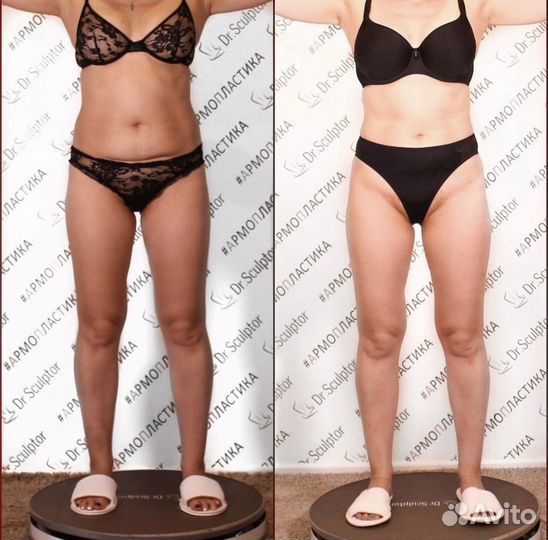 Армопластика