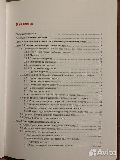 Рассеянный склероз