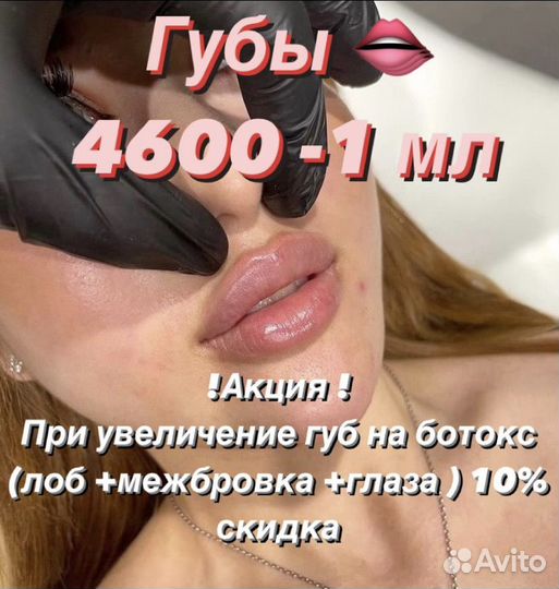 Увеличение губ
