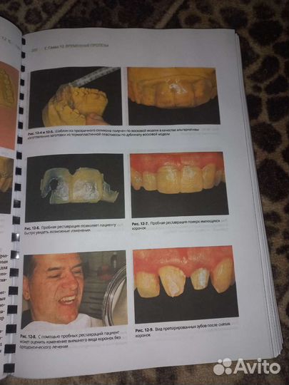 Протезирование с опорой на имплантаты книга