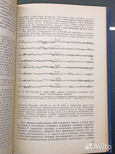 Биоэлектрическая активность головного мозга 1971