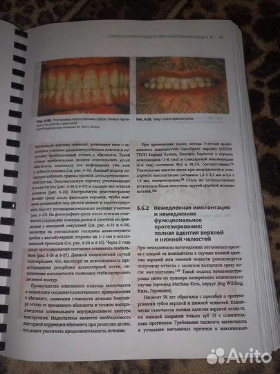 Протезирование с опорой на имплантаты книга