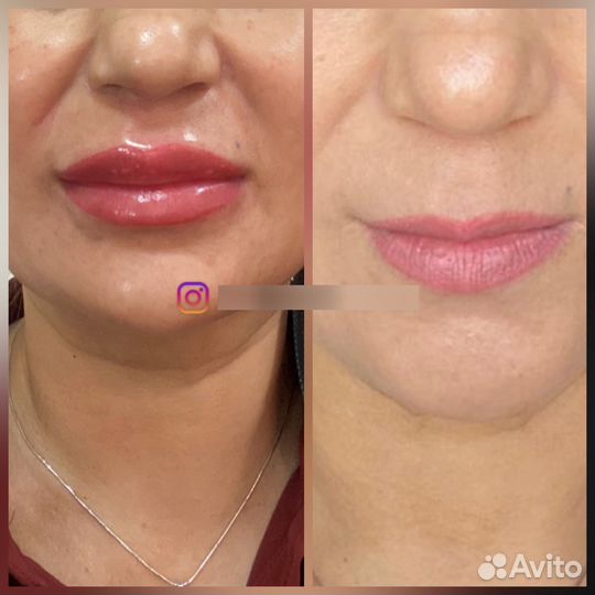 Перманентный макияж губ