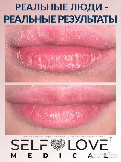 SelfLoveMedical Make Love Отшелушивающий скраб для