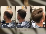 Система замещения волос + установка + стрижка