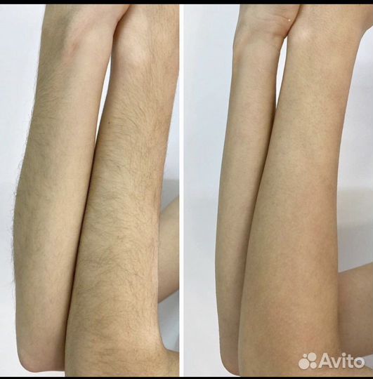 SPA-шугаринг,восковая депиляция, коррекция бровей
