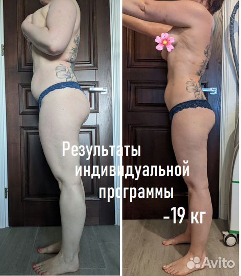 Коррекция фигуры (аппаратная:LPG,Turbo и много др)