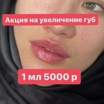 Увеличение губ 0.5 мл, 1 мл