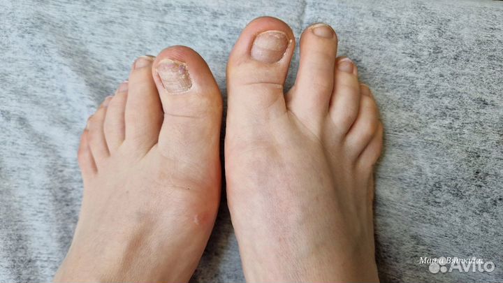 Педикюр на дому