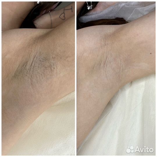 Модель на шугаринг