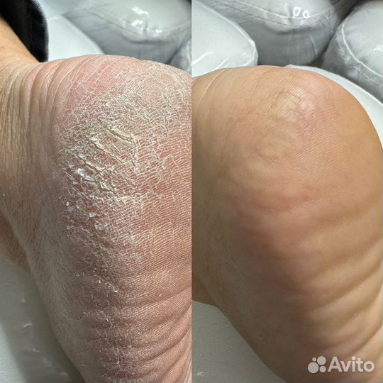 Модели на педикюр