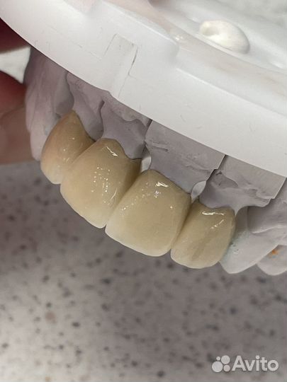 Зубной техник