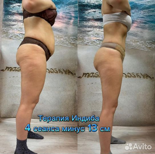 Массаж/Индиба