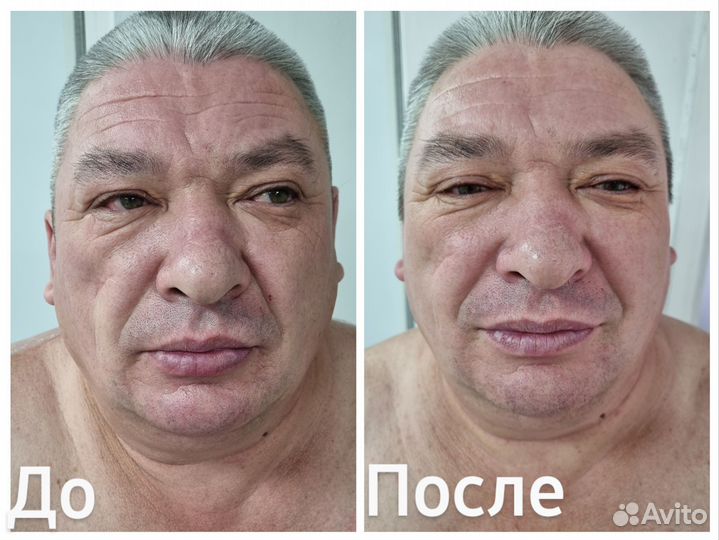 Услуги массажиста