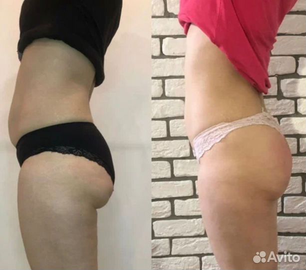 Липолитики